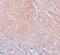 CXXC Finger Protein 5 antibody, PA5-21080, Invitrogen Antibodies, Immunohistochemistry paraffin image 