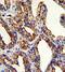 Tumor Associated Calcium Signal Transducer 2 antibody, GTX81777, GeneTex, Immunohistochemistry paraffin image 