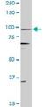 Progesterone Receptor antibody, H00005241-M08, Novus Biologicals, Western Blot image 