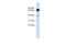 Mannosidase Alpha Class 1A Member 2 antibody, 26-162, ProSci, Western Blot image 