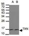 Thioredoxin antibody, NBP1-31090, Novus Biologicals, Western Blot image 