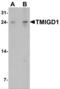 Transmembrane And Immunoglobulin Domain Containing 1 antibody, NBP2-81844, Novus Biologicals, Western Blot image 