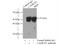 Calcium/Calmodulin Dependent Protein Kinase II Beta antibody, 20667-1-AP, Proteintech Group, Immunoprecipitation image 