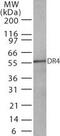 TNF Receptor Superfamily Member 10a antibody, MA1-41049, Invitrogen Antibodies, Western Blot image 