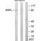 Phosphofructokinase, Liver Type antibody, PA5-49791, Invitrogen Antibodies, Western Blot image 