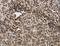 Activin A Receptor Type 1B antibody, LS-C403709, Lifespan Biosciences, Immunohistochemistry paraffin image 