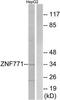 Zinc Finger Protein 771 antibody, TA315467, Origene, Western Blot image 