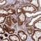 TNF Superfamily Member 10 antibody, HPA054938, Atlas Antibodies, Immunohistochemistry paraffin image 
