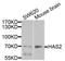 Hyaluronan Synthase 2 antibody, STJ111939, St John