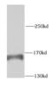 Kinectin 1 antibody, FNab04660, FineTest, Western Blot image 