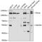 Prolyl 4-Hydroxylase, Transmembrane antibody, 22-028, ProSci, Western Blot image 