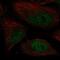 DNA Polymerase Kappa antibody, NBP2-57541, Novus Biologicals, Immunocytochemistry image 