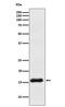 VAMP1 antibody, M05982-2, Boster Biological Technology, Western Blot image 