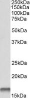 Cystatin B antibody, EB06131, Everest Biotech, Western Blot image 