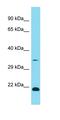Family With Sequence Similarity 192 Member A antibody, orb326996, Biorbyt, Western Blot image 