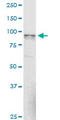 N-Acetyl-Alpha-Glucosaminidase antibody, LS-C197744, Lifespan Biosciences, Western Blot image 