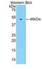 Coagulation Factor VIII antibody, LS-B11726, Lifespan Biosciences, Western Blot image 