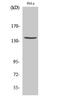 Spectrin Alpha, Non-Erythrocytic 1 antibody, A03831, Boster Biological Technology, Western Blot image 