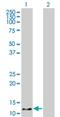 Hemoglobin Subunit Zeta antibody, H00003050-M03, Novus Biologicals, Western Blot image 