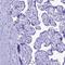 Marginal Zone B And B1 Cell Specific Protein antibody, HPA043745, Atlas Antibodies, Immunohistochemistry frozen image 