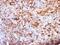 Ig kappa-b4 chain C region antibody, NBP2-48237, Novus Biologicals, Immunohistochemistry paraffin image 
