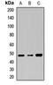 Transmembrane Serine Protease 11A antibody, orb412808, Biorbyt, Western Blot image 
