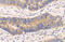 Mechanistic Target Of Rapamycin Kinase antibody, GTX101557, GeneTex, Immunohistochemistry paraffin image 