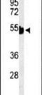 Keratin 1 antibody, PA5-26699, Invitrogen Antibodies, Western Blot image 