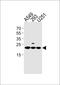 Transmembrane Protein 199 antibody, PA5-35242, Invitrogen Antibodies, Western Blot image 