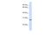 Tetraspanin 6 antibody, A13910, Boster Biological Technology, Western Blot image 