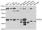 Purinergic Receptor P2X 2 antibody, A7078, ABclonal Technology, Western Blot image 