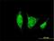 Alcohol Dehydrogenase 1B (Class I), Beta Polypeptide antibody, H00000125-B01P, Novus Biologicals, Immunofluorescence image 