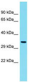 Chromosome 6 Open Reading Frame 136 antibody, TA334817, Origene, Western Blot image 