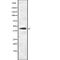 Potassium Two Pore Domain Channel Subfamily K Member 3 antibody, abx216390, Abbexa, Western Blot image 