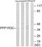 Protein Phosphatase 1 Regulatory Subunit 3C antibody, A06658, Boster Biological Technology, Western Blot image 