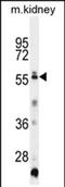 Tripartite Motif Family Like 1 antibody, PA5-71589, Invitrogen Antibodies, Western Blot image 