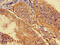 Solute carrier family 22 member 2 antibody, CSB-PA021453LA01HU, Cusabio, Immunohistochemistry frozen image 