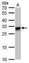 Major Histocompatibility Complex, Class II, DQ Beta 1 antibody, PA5-78003, Invitrogen Antibodies, Western Blot image 