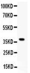 FYN Proto-Oncogene, Src Family Tyrosine Kinase antibody, PB9197, Boster Biological Technology, Western Blot image 