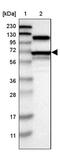 Arginyl-tRNA synthetase, cytoplasmic antibody, PA5-52057, Invitrogen Antibodies, Western Blot image 