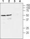 GDNF Family Receptor Alpha 4 antibody, TA328909, Origene, Western Blot image 