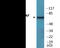 Raf-1 Proto-Oncogene, Serine/Threonine Kinase antibody, EKC2500, Boster Biological Technology, Western Blot image 