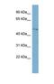 Core 1 Synthase, Glycoprotein-N-Acetylgalactosamine 3-Beta-Galactosyltransferase 1 antibody, NBP1-69602, Novus Biologicals, Western Blot image 