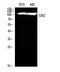 Complement C3d Receptor 2 antibody, A01632-1, Boster Biological Technology, Western Blot image 