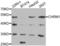 Acetylcholine Receptor antibody, LS-C331571, Lifespan Biosciences, Western Blot image 