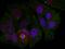 Myocyte-specific enhancer factor 2A antibody, GTX50115, GeneTex, Immunofluorescence image 