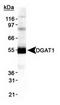 Diacylglycerol O-Acyltransferase 1 antibody, TA309624, Origene, Western Blot image 