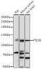 Protein Tyrosine Kinase 2 Beta antibody, 16-395, ProSci, Western Blot image 