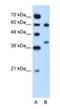 Arginase 1 antibody, NBP1-54621, Novus Biologicals, Western Blot image 