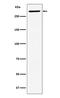 Ubiquitin Protein Ligase E3 Component N-Recognin 5 antibody, M03160, Boster Biological Technology, Western Blot image 